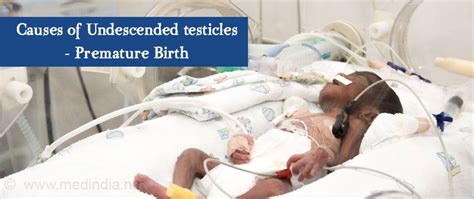 birthdefect where the testes fail to drop|unexplained testicles after birth.